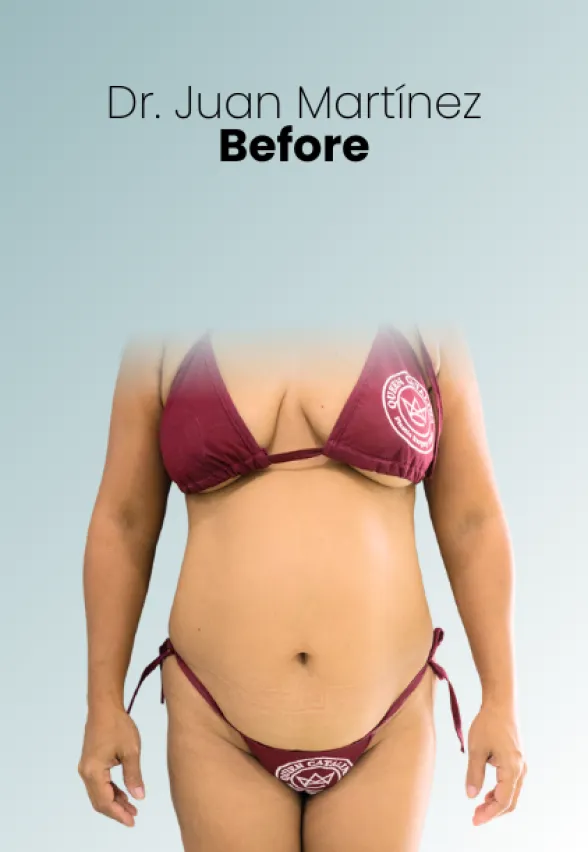 Surgeon Biography Juan Martinez Procedure Img60 Queen Catalina