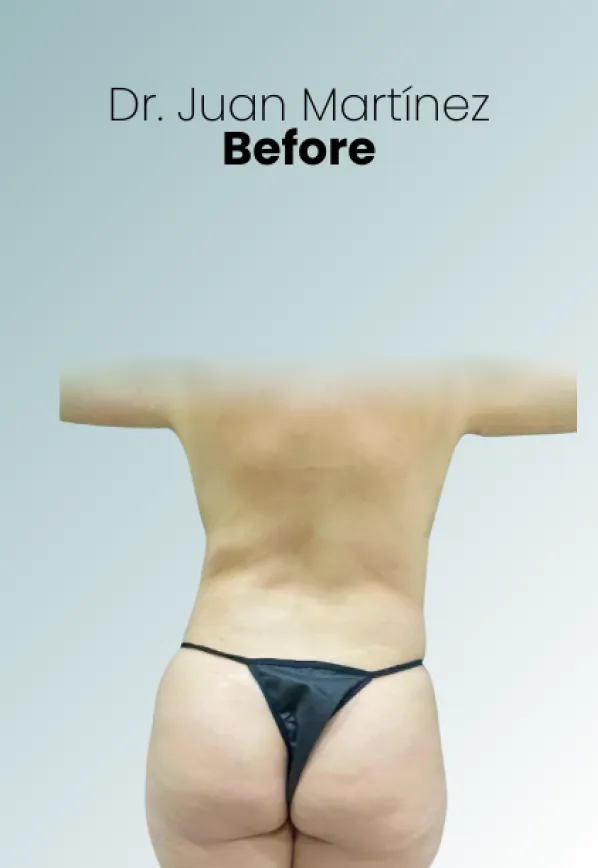 Surgeon Biography Juan Martinez Procedure Img64 Queen Catalina