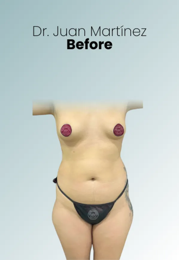 Surgeon Biography Juan Martinez Procedure Img68 Queen Catalina