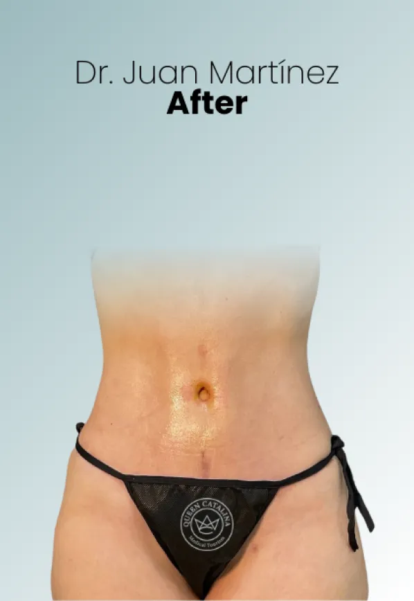 Surgeon Biography Juan Martinez Procedure Img69 Queen Catalina