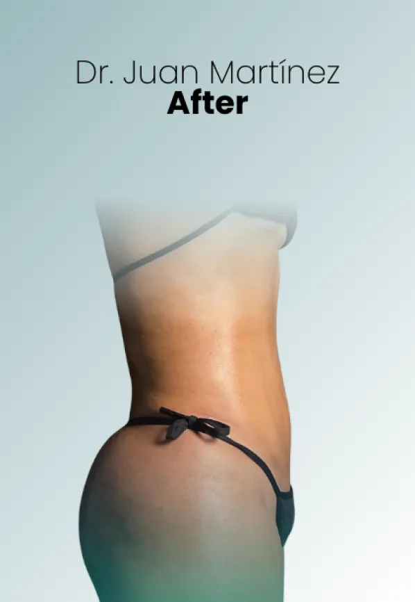 Surgeon Biography Juan Martinez Procedure Img71 Queen Catalina