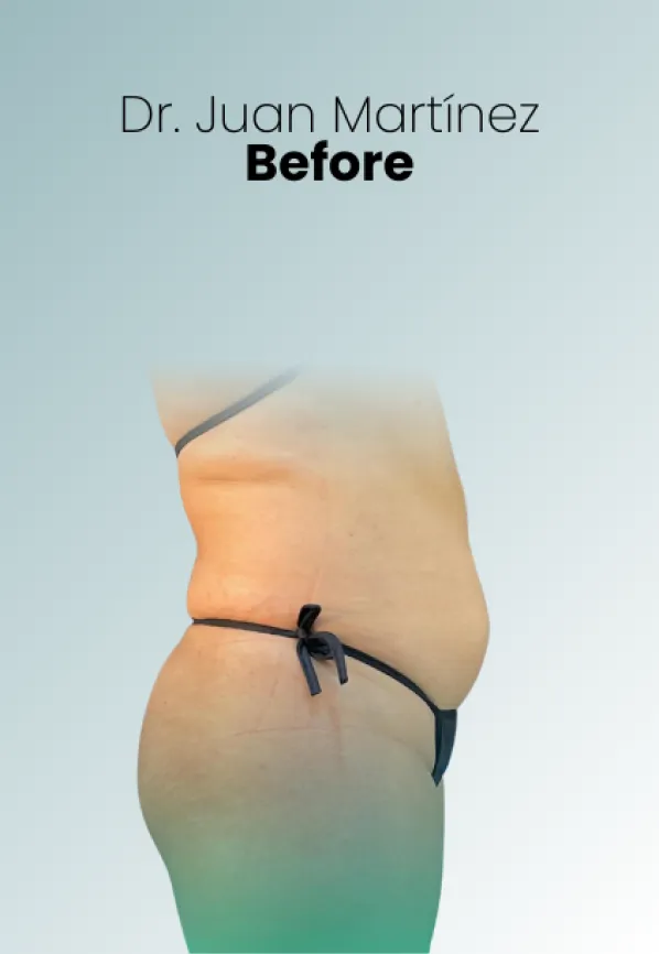 Surgeon Biography Juan Martinez Procedure Img72 Queen Catalina