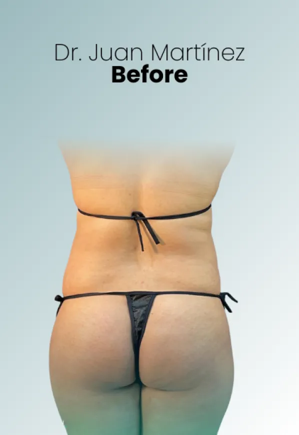 Surgeon Biography Juan Martinez Procedure Img76 Queen Catalina