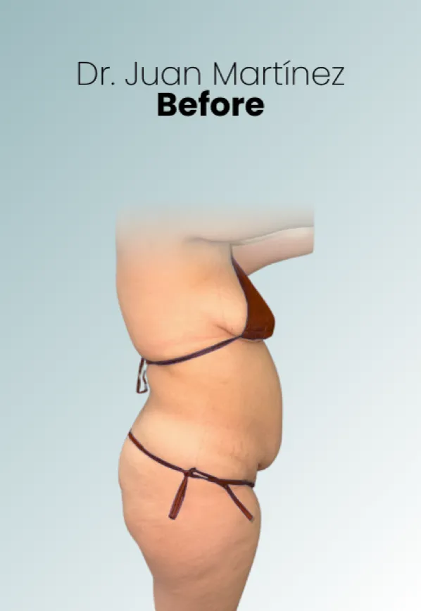 Surgeon Biography Juan Martinez Procedure Img83 Queen Catalina