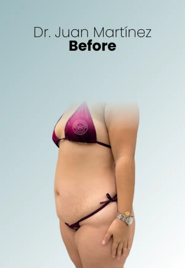 Surgeon Biography Juan Martinez Procedure Img89 Queen Catalina