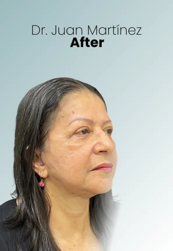 Surgeon Biography Juan Martinez Procedure Img9 Queen Catalina