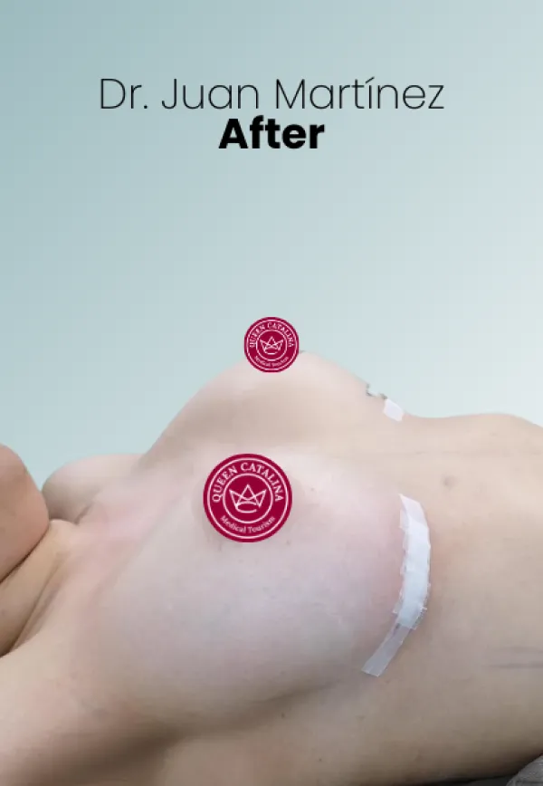 Surgeon Biography Juan Martinez Procedure Img92 Queen Catalina