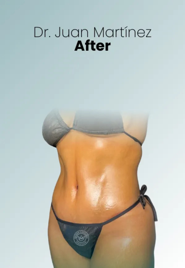 Surgeon Biography Juan Martinez Procedure Img94 Queen Catalina