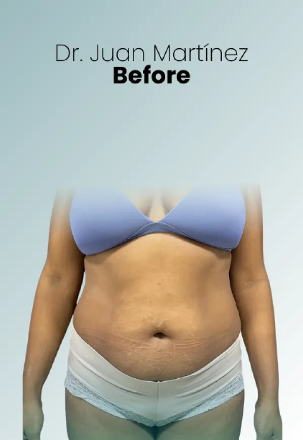 Surgeon Biography Juan Martinez Procedure Img97 Queen Catalina