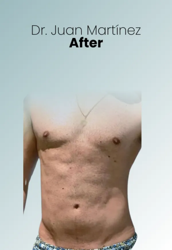 Surgeon Biography Juan Martinez Procedure Img98 Queen Catalina