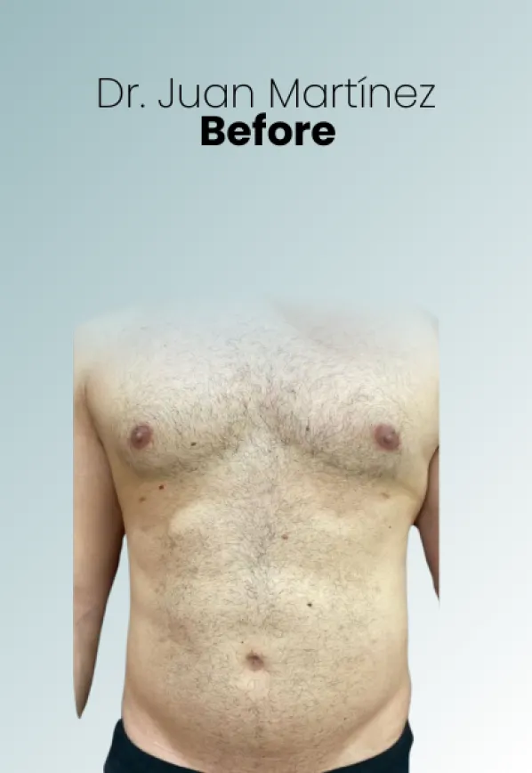 Surgeon Biography Juan Martinez Procedure Img99 Queen Catalina