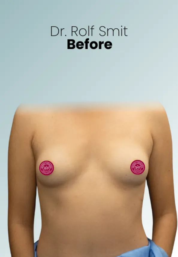 Surgeon Biography Rolf Smit Procedure Img10 Queen Catalina