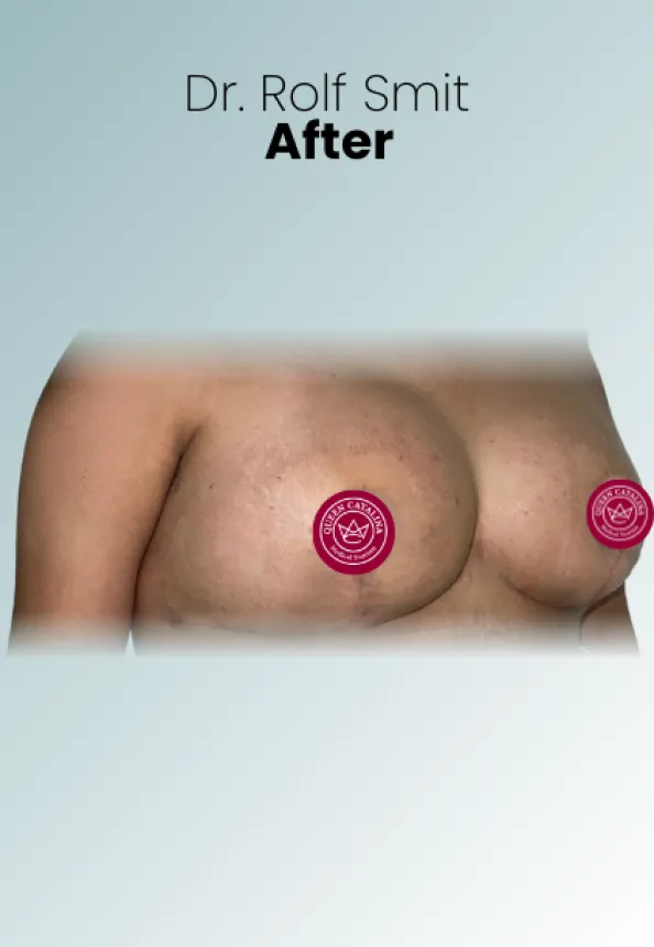 Surgeon Biography Rolf Smit Procedure Img11 Queen Catalina