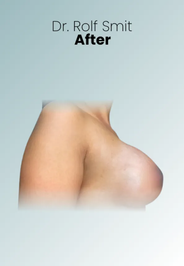 Surgeon Biography Rolf Smit Procedure Img13 Queen Catalina