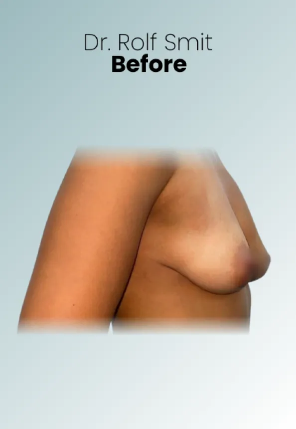 Surgeon Biography Rolf Smit Procedure Img14 Queen Catalina