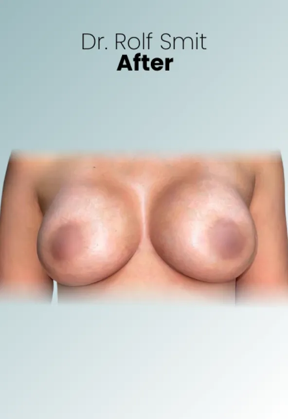 Surgeon Biography Rolf Smit Procedure Img15 Queen Catalina