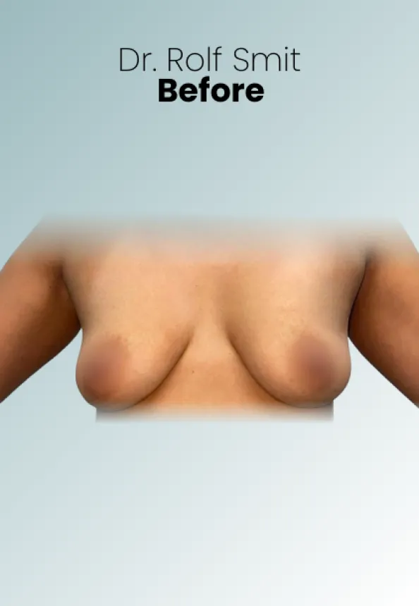 Surgeon Biography Rolf Smit Procedure Img16 Queen Catalina