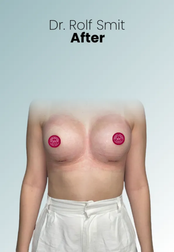 Surgeon Biography Rolf Smit Procedure Img19 Queen Catalina