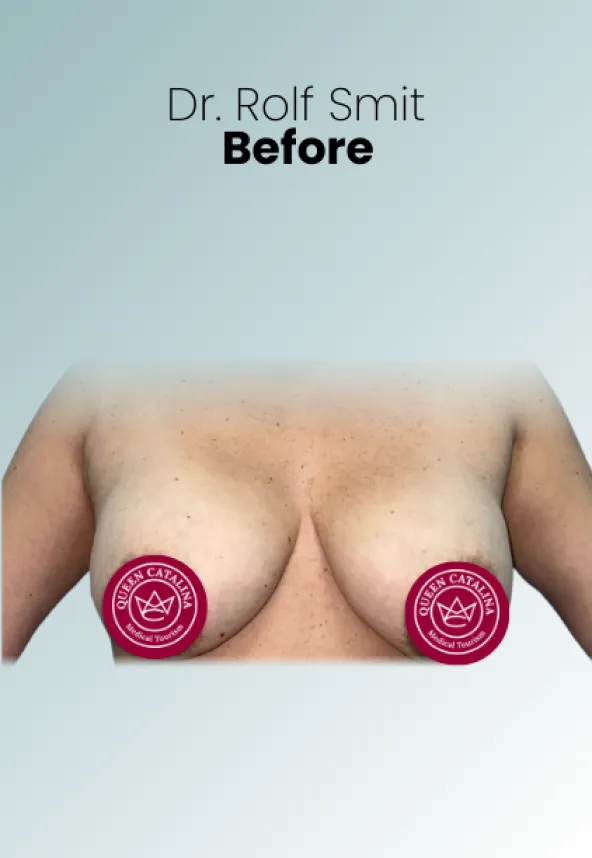 Surgeon Biography Rolf Smit Procedure Img2 Queen Catalina