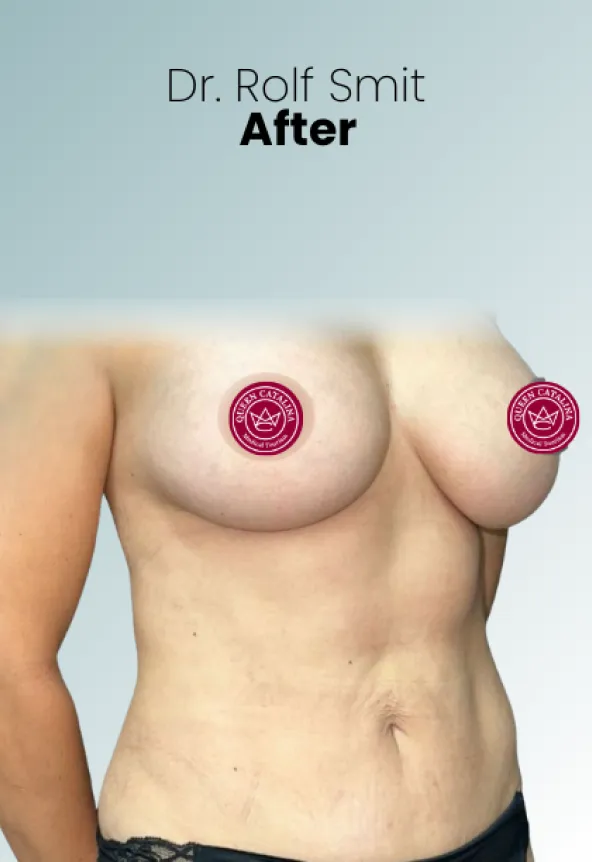 Surgeon Biography Rolf Smit Procedure Img21 Queen Catalina