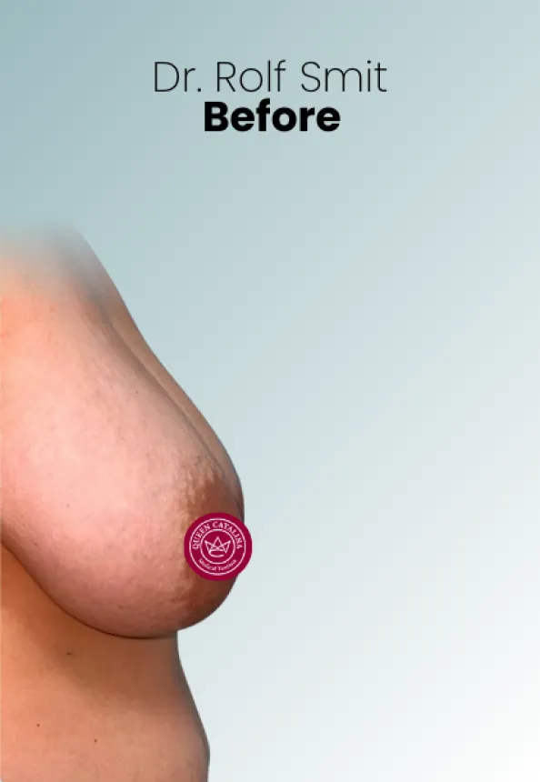 Surgeon Biography Rolf Smit Procedure Img28 Queen Catalina