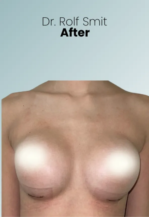 Surgeon Biography Rolf Smit Procedure Img3 Queen Catalina