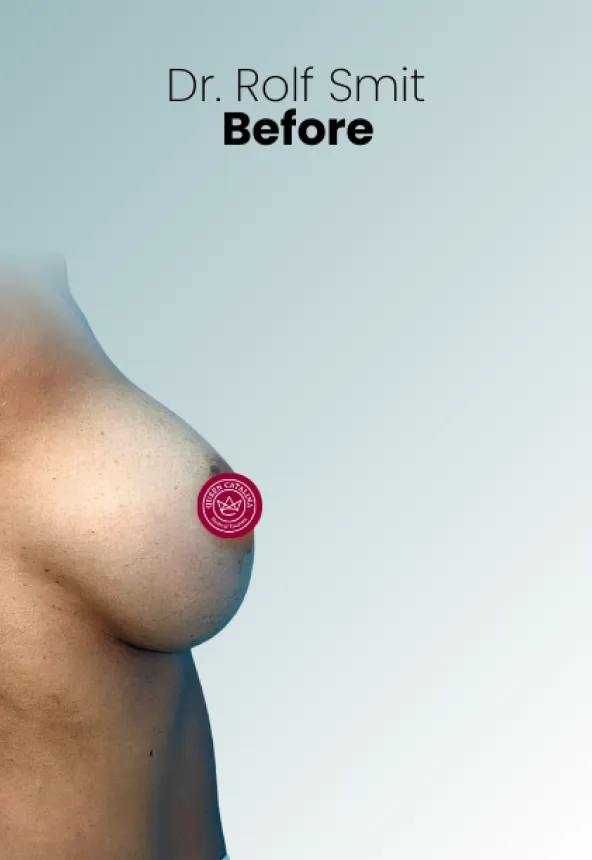 Surgeon Biography Rolf Smit Procedure Img30 Queen Catalina