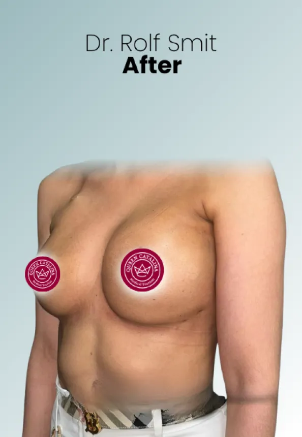 Surgeon Biography Rolf Smit Procedure Img31 Queen Catalina