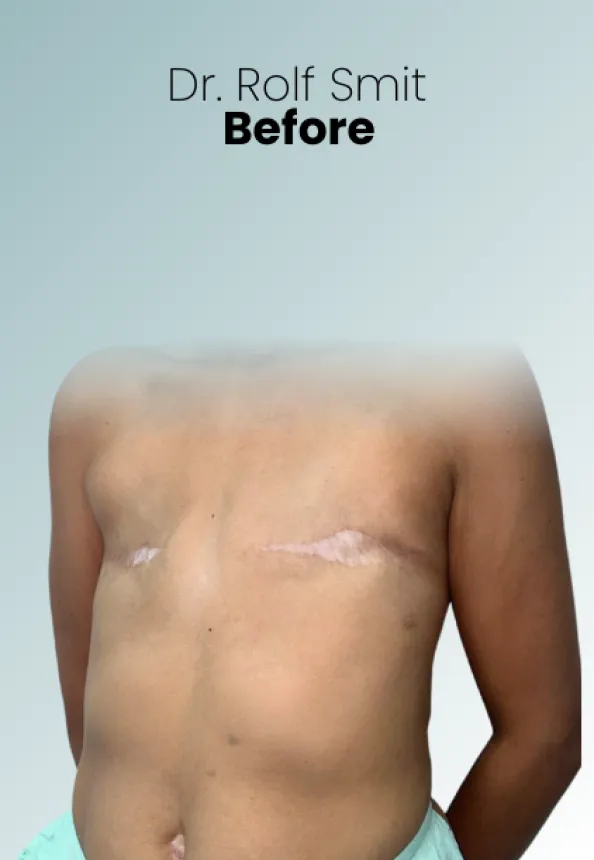 Surgeon Biography Rolf Smit Procedure Img34 Queen Catalina