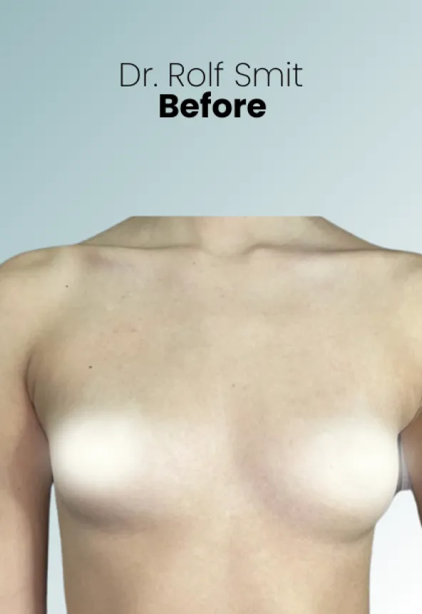 Surgeon Biography Rolf Smit Procedure Img4 Queen Catalina