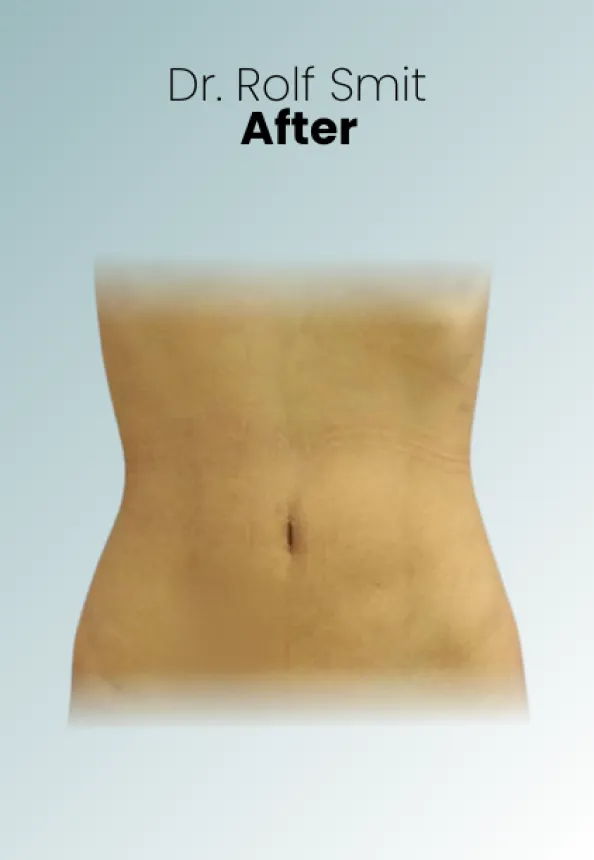 Surgeon Biography Rolf Smit Procedure Img5 Queen Catalina