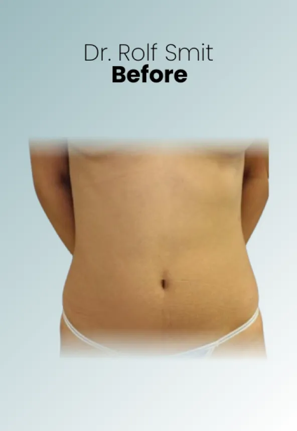 Surgeon Biography Rolf Smit Procedure Img6 Queen Catalina