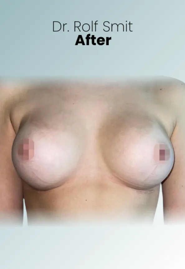 Surgeon Biography Rolf Smit Procedure Img7 Queen Catalina