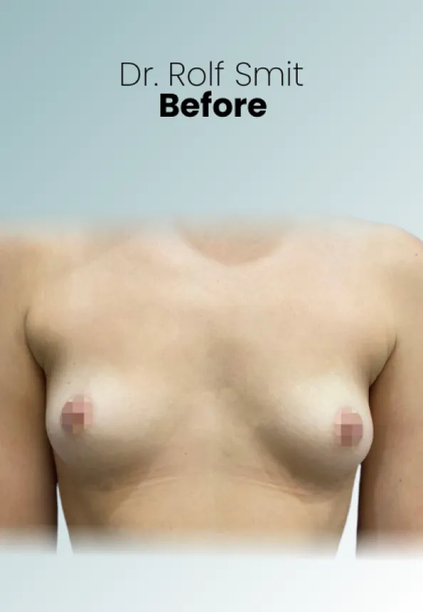 Surgeon Biography Rolf Smit Procedure Img8 Queen Catalina