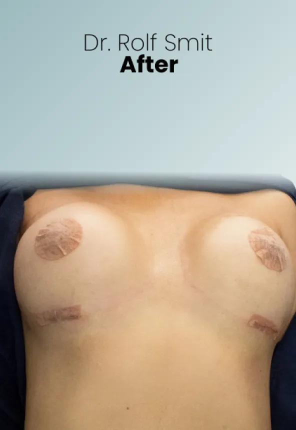 Surgeon Biography Rolf Smit Procedure Img9 Queen Catalina